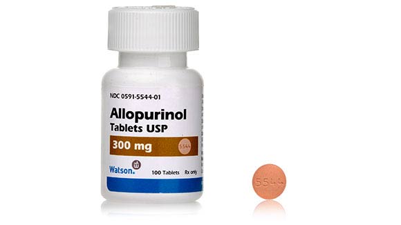 Allopurinol 300 mg, 30 Tablets